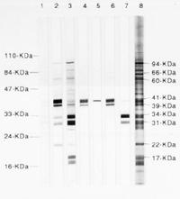 FIV vaccine adjuvant household cat safety sarcoma clades strains efficacy